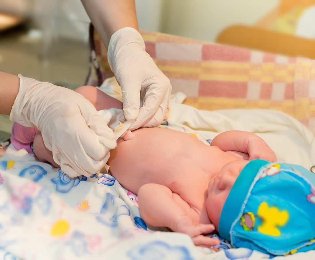 A mother or FDW wearing gloves, putting on a diaper on a newborn